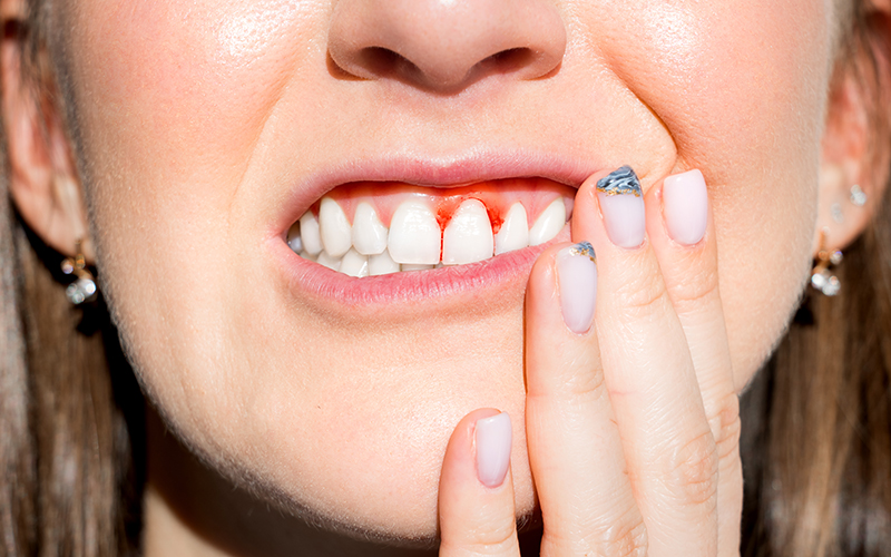 千葉市中央区の歯医者、千葉スマイル歯科&矯正歯科で歯周病治療