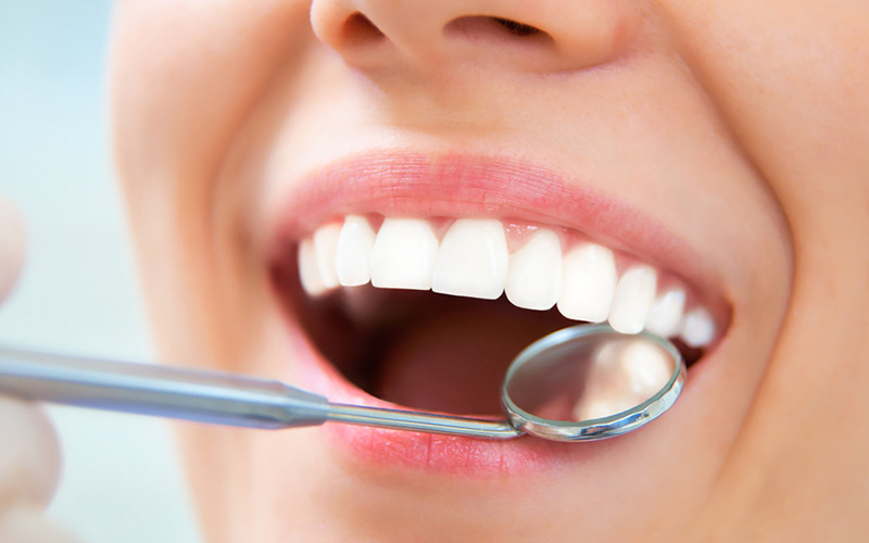 千葉市中央区の歯医者、千葉スマイル歯科&矯正歯科で予防歯科