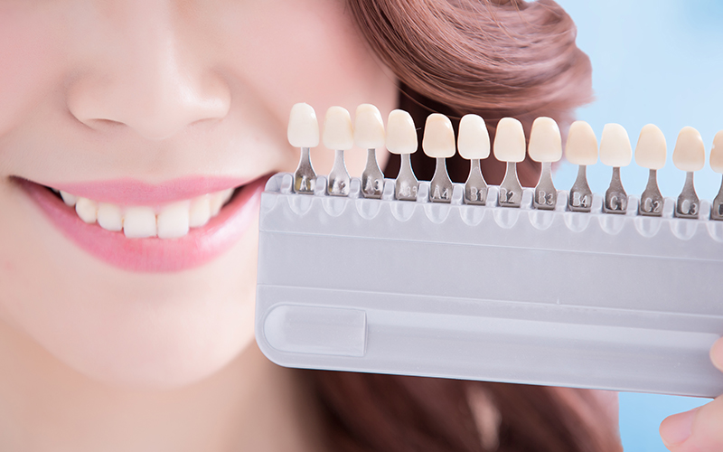 千葉市中央区の歯医者、千葉スマイル歯科&矯正歯科でホワイトニング